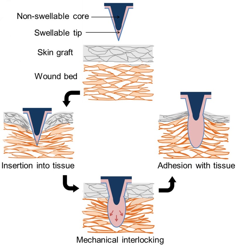 The microneedle patches reportedly produce over three times the adhesion strength of sutures or surgical staples (Image: Karp lab)