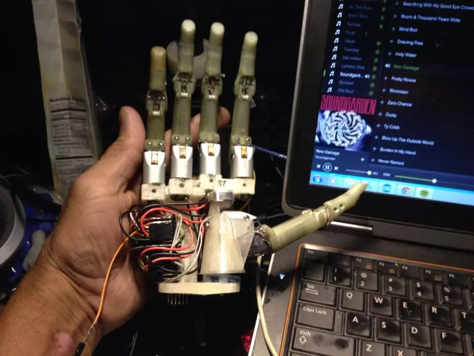 Connor still has to create an artificial skin covering, and hopes to ultimately make the entire hand commercially available as a $4,000 kit