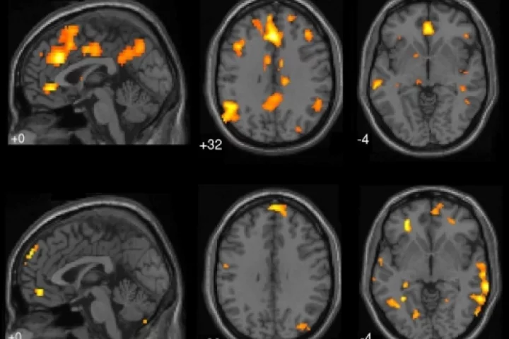 fMRI brain scans from UBC Mind Wandering Study(Image: Courtesy of Kalina Christoff)