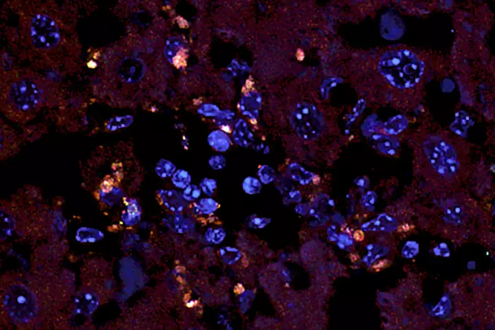Orange dots represent the gut bacterium known to cause an autoimmune disease in liver tissue