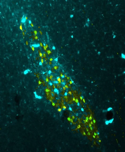 A fluorescent image of the region of the birds' brain that the researchers targeted