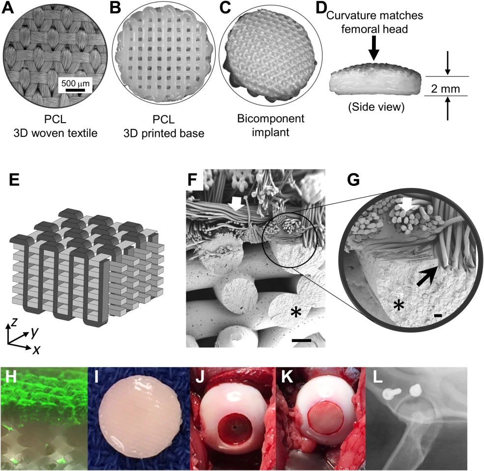 Configuration of the implant and surgical procedure