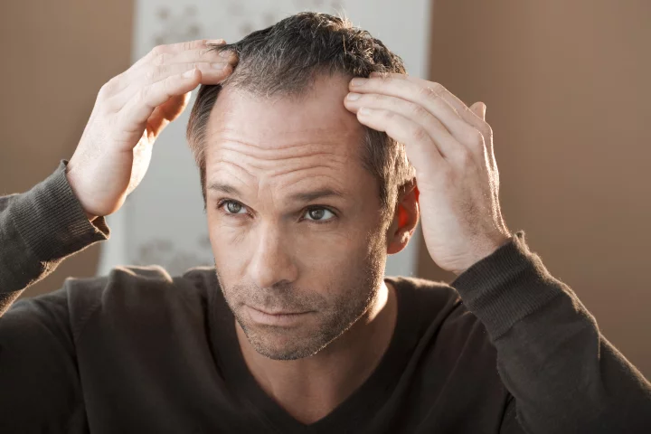A new immune drug, delivered through microneedle patches, could help reverse hair loss from alopecia