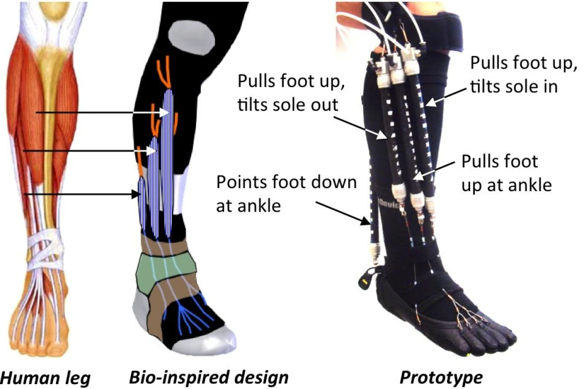A diagram of the experimental orthotic device