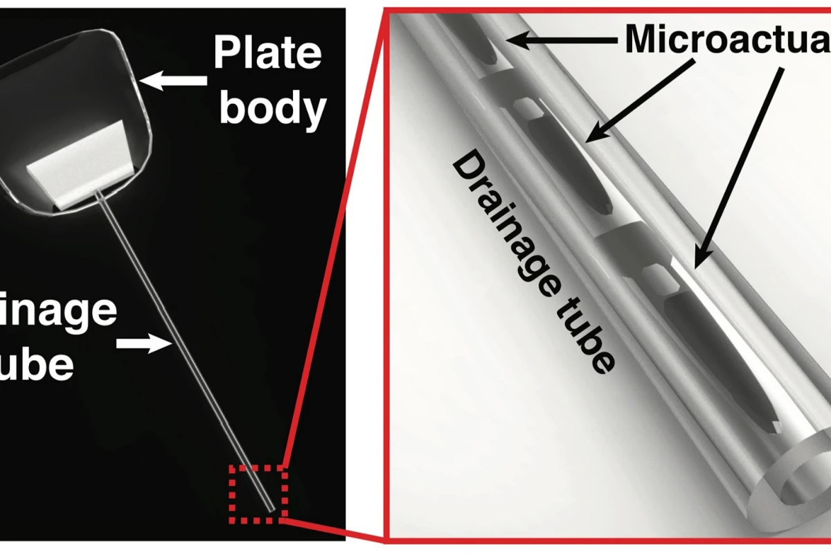 The implant is activated via externally-applied magnetic fields