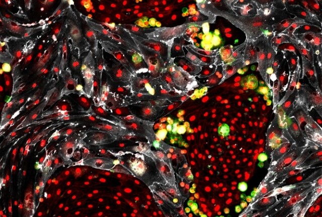 This image shows reprogrammed hematopoietic stem cells (green) that are arising from mouse cells