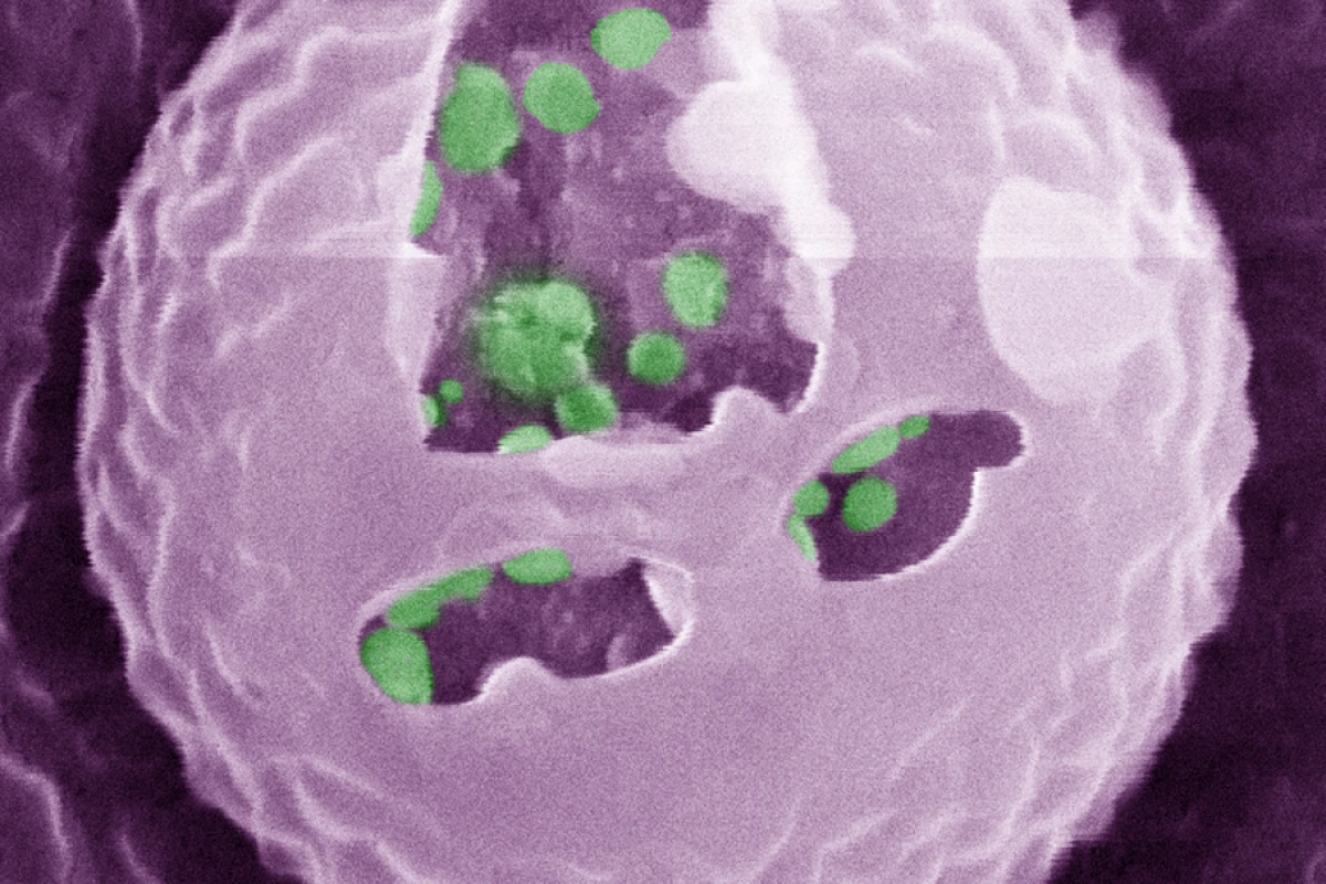 An image of one of the artificial beta cells that can be inserted into a diabetic patient and regulate their glucose levels