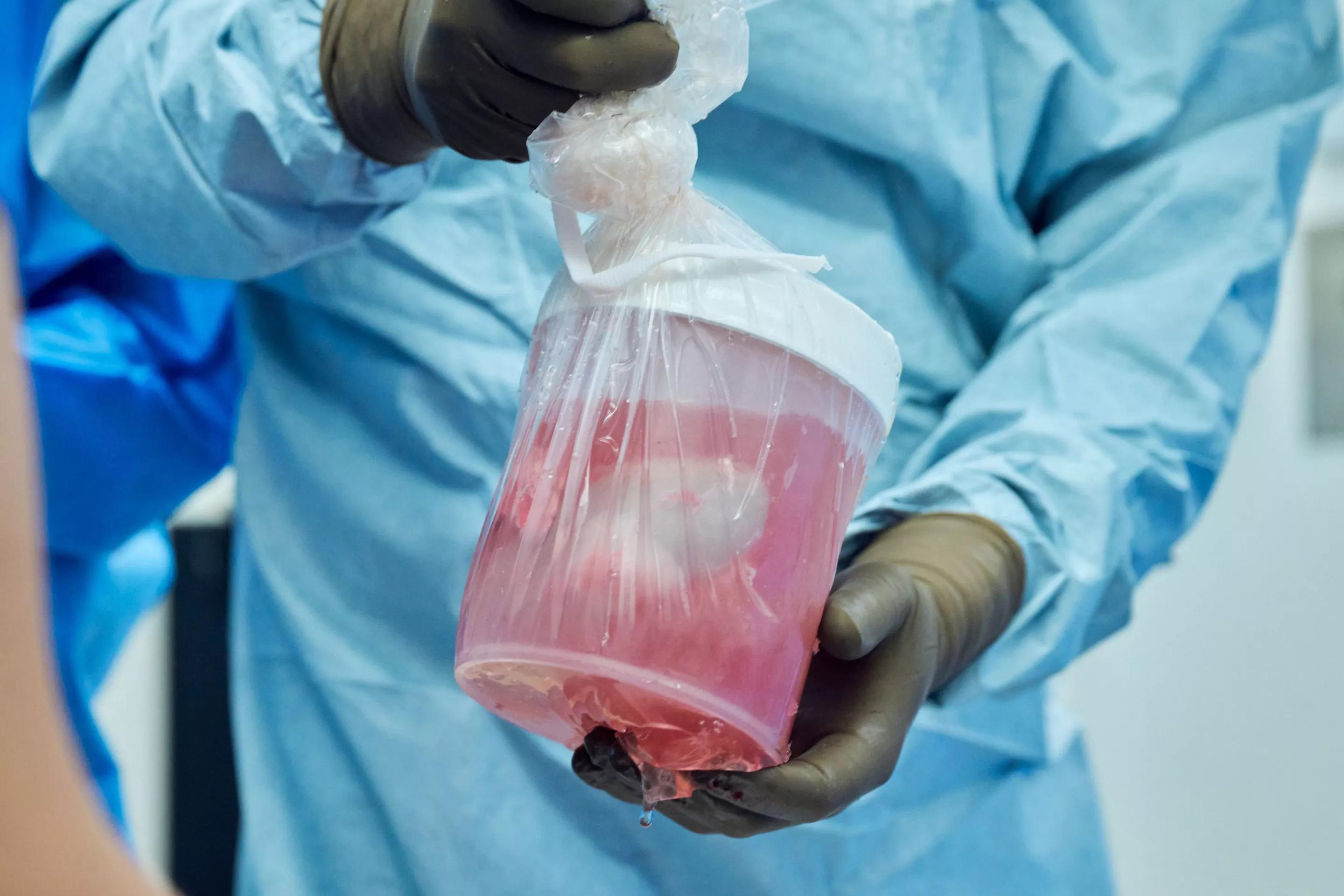 Pig Kidney being transported
