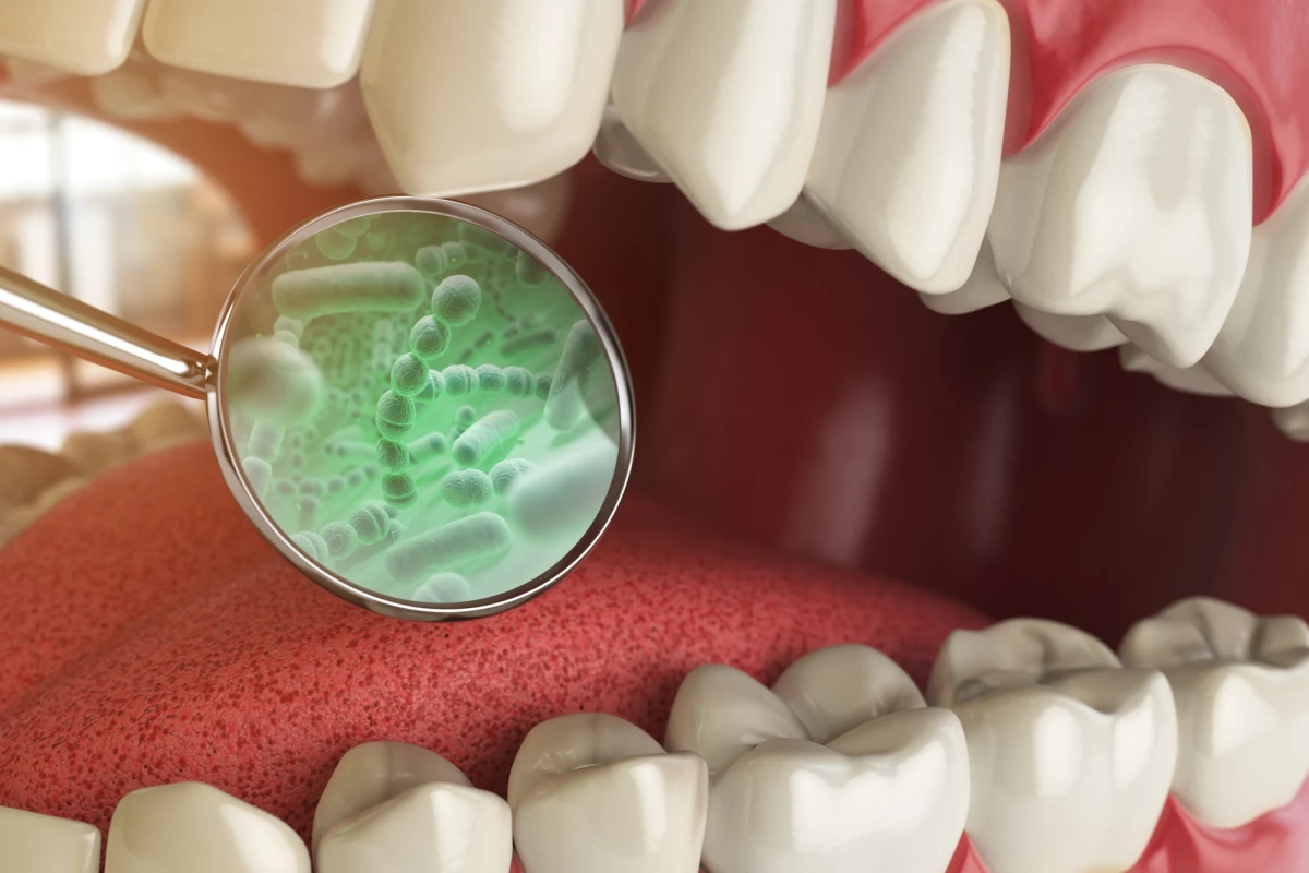 Detailed animal studies have revealed two potential mechanisms by which oral bacteria could exacerbate the gut inflammation seen in inflammatory bowel disease