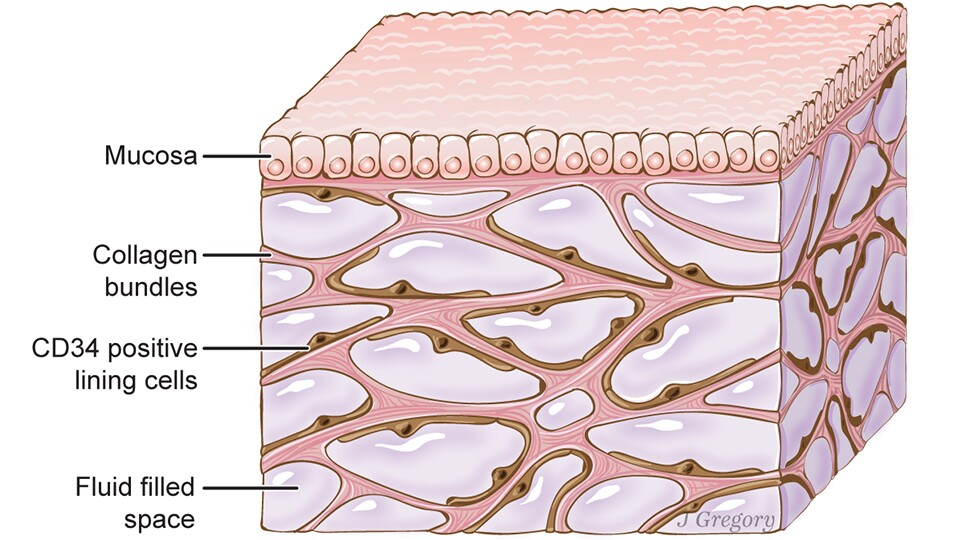 Seen beneath the top layer of the skin, this is an artist impression of the interstitium (Credit: Illustration by Jill Gregory. Printed with permission from Mount Sinai Health System, licensed under CC-BY-ND)