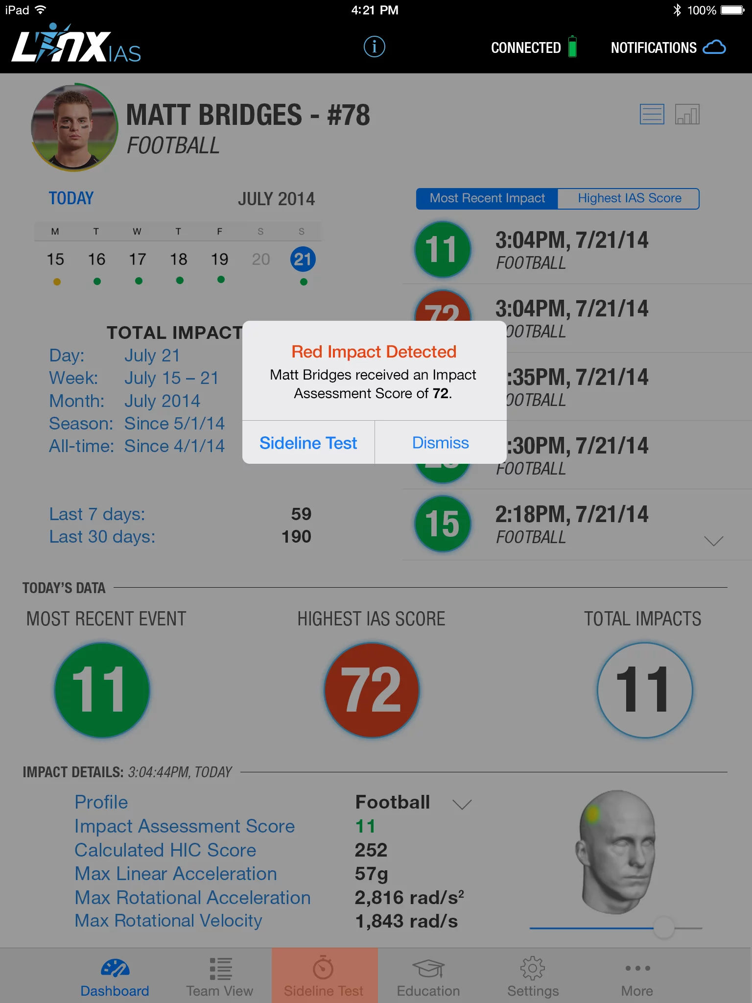 The Linx IAS app provides a simple 1 to 100 score that you can use to assess your likelihood of concussion