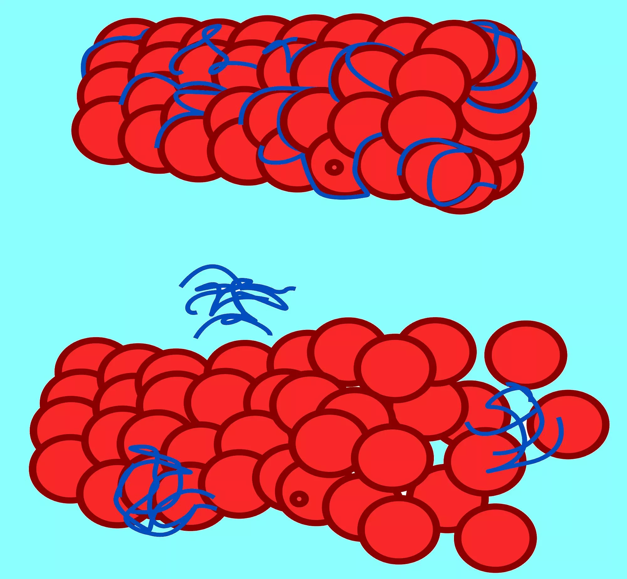 Schematic of a normal neuronal microtubule (top) and a microtubule no longer stabilized by tau proteins (Image: Resident Mario via Wikipedia)