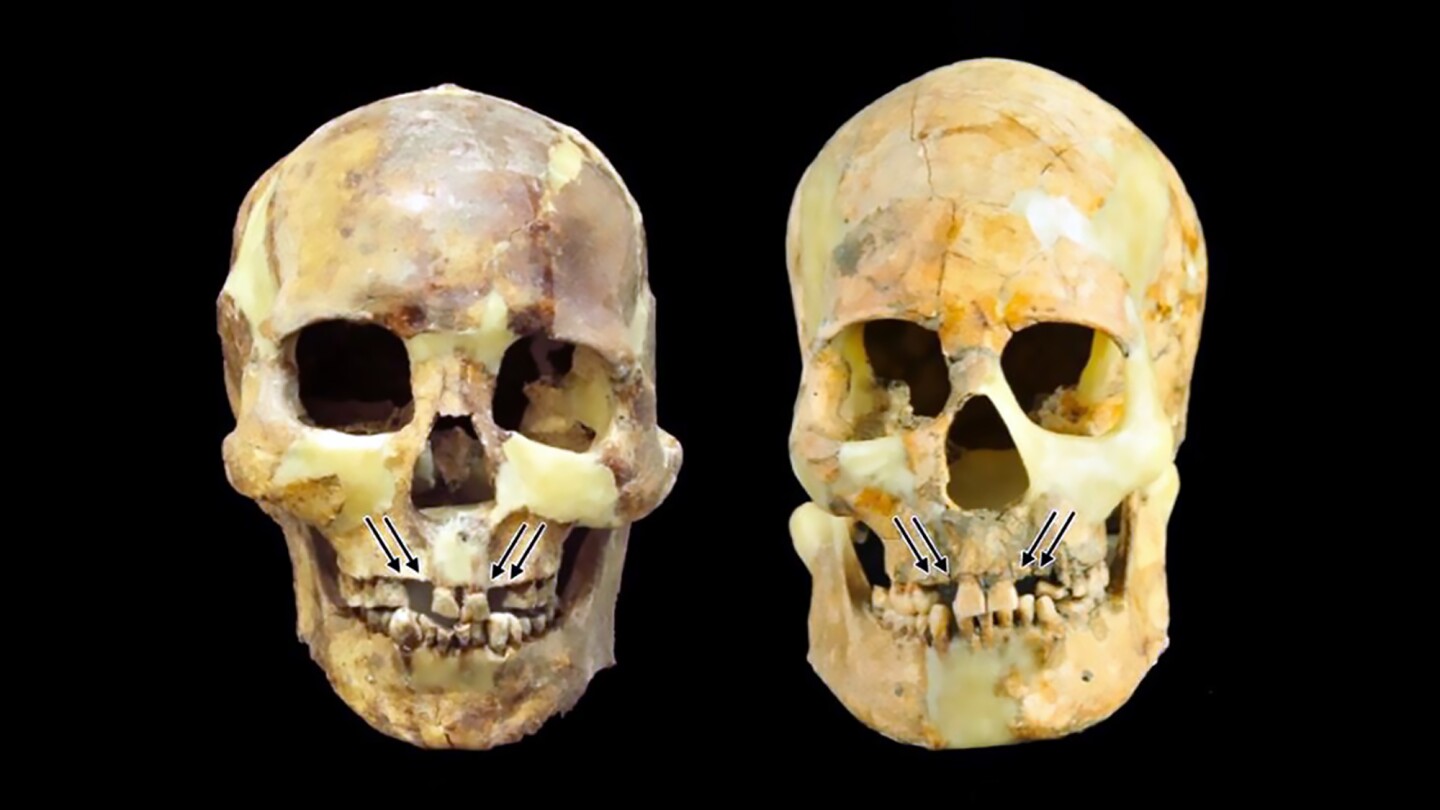 This is one beauty trend we don't think will be making a comeback anytime soon