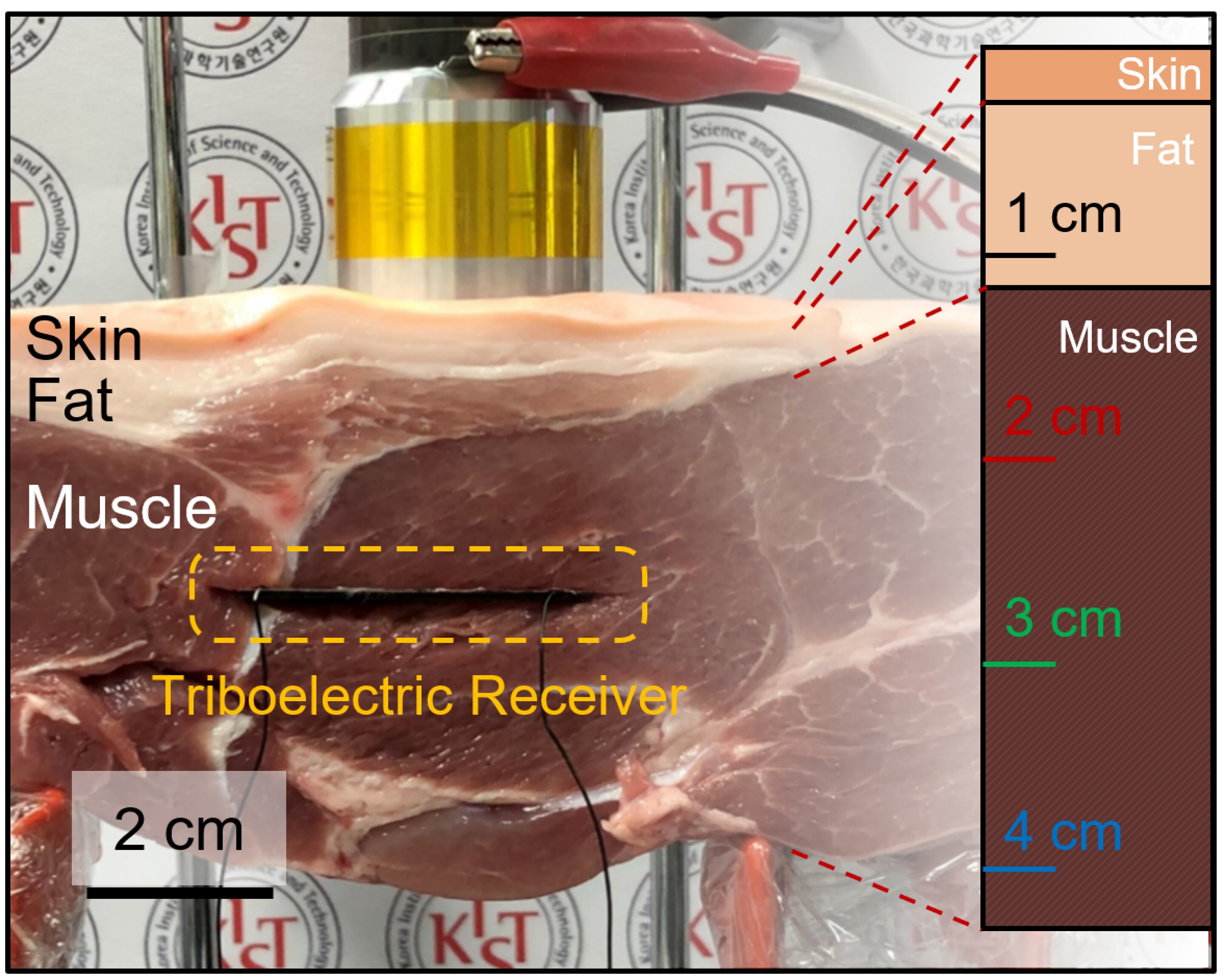 Implanted generator could use ultrasound to charge pacemaker batteries