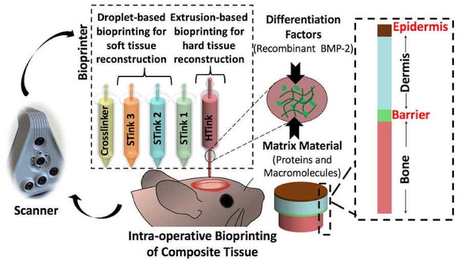 A schematic of the new combination skin-and-bone bioprinting technique