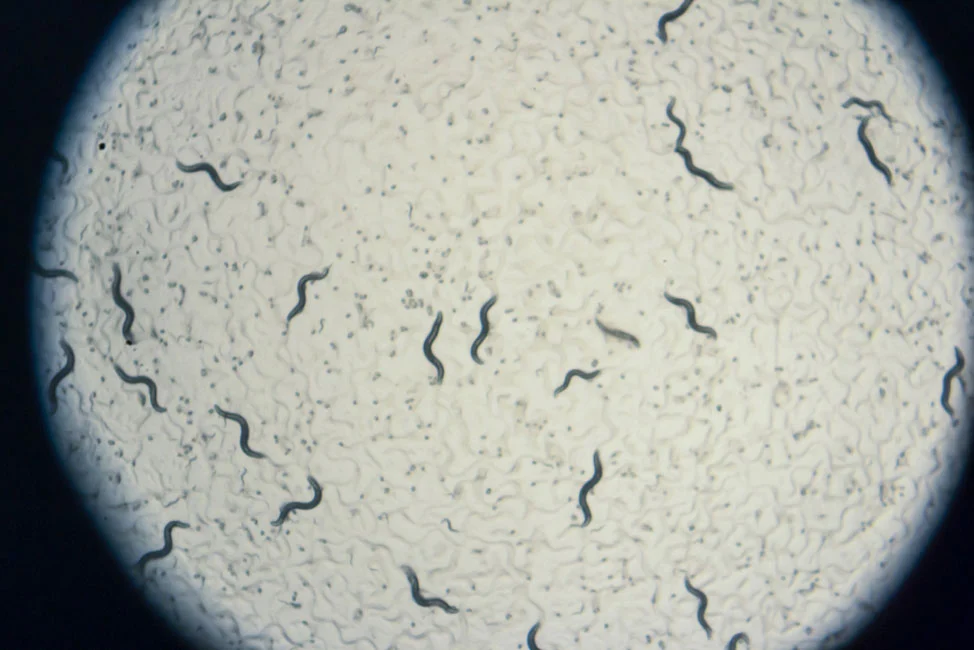 An "axis of aging" mechanism has been uncovered in the worm species C. elegans, seen here under a microscope