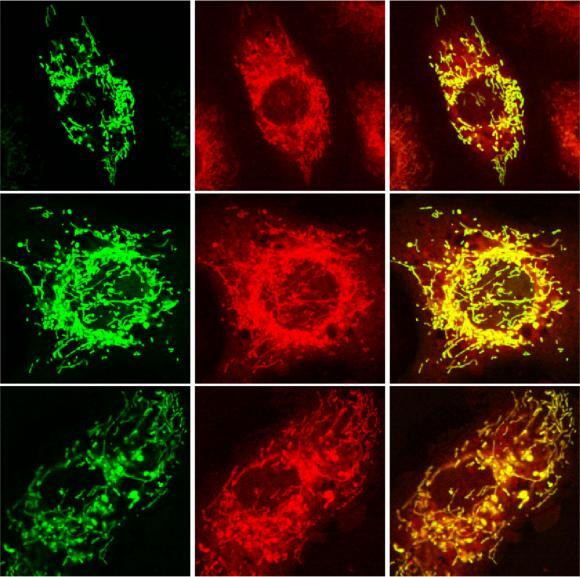 Left shows the protein Sirt4 (green), the middle is the mitochondria of cells (red) and on the right, the two overlap in yellow