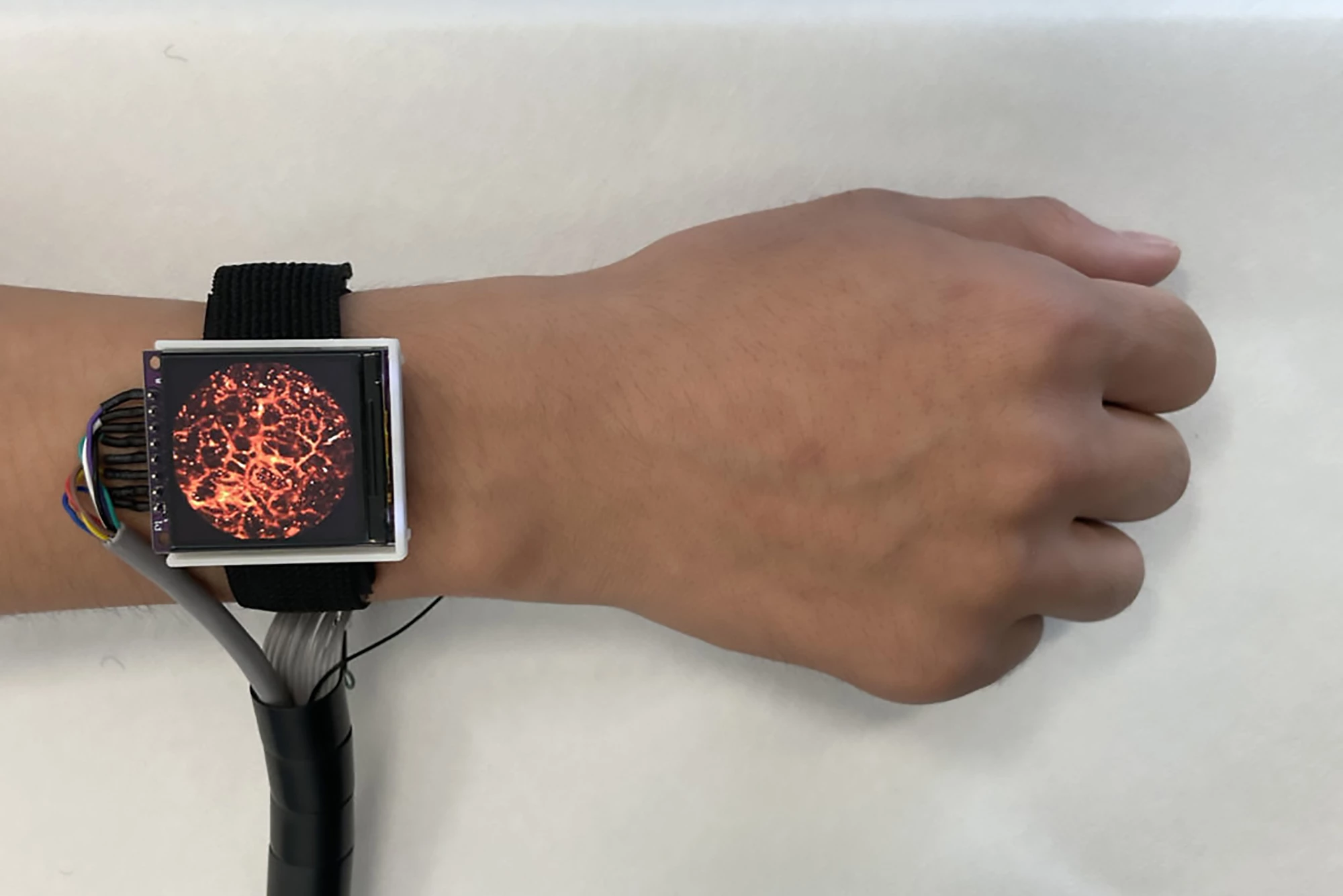 The photoacoustic watch can capture high-resolution images of blood vessels in the skin
