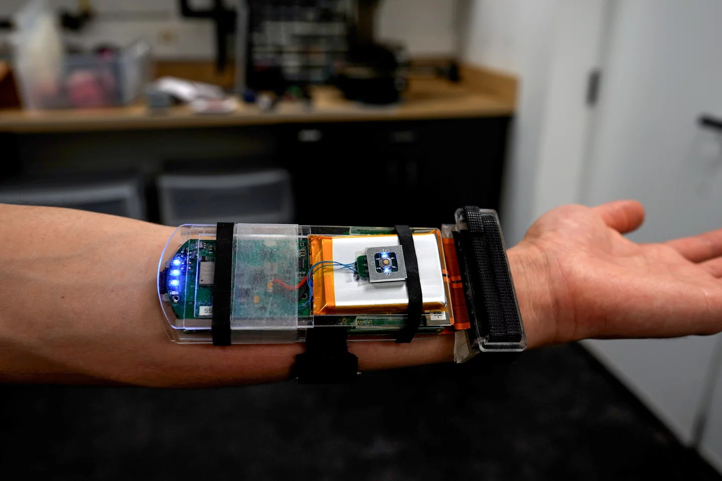 The prototype wristband, which could be made considerably smaller if commercialized
