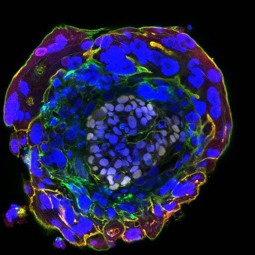 The embryo at day 11
