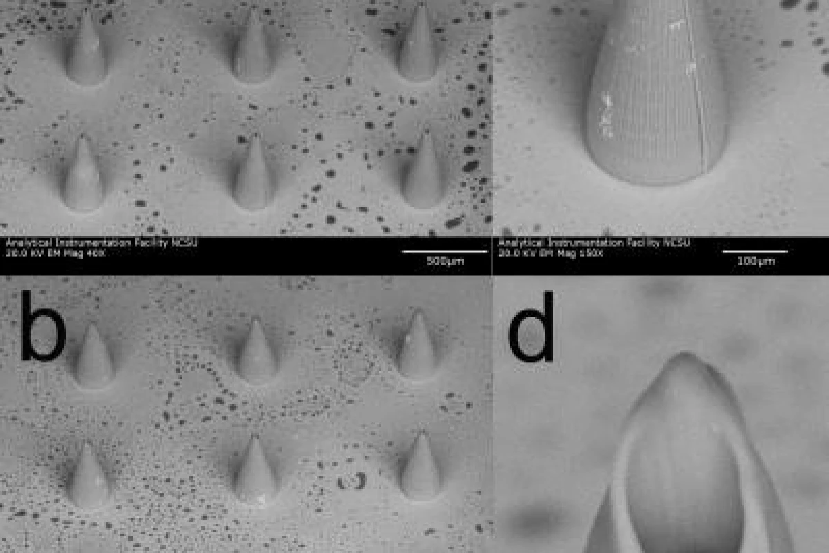 Hollow microneedles open the door to new techniques for diagnosing and treating a variety of medical conditions (Image: Roger Narayan, Faraday Discussions - Reproduced by permission of the Royal Society of Chemistry)