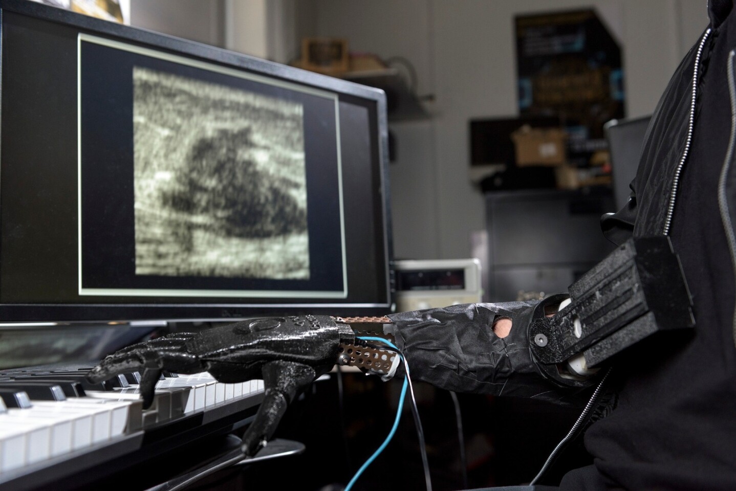 The robotic arm developed at Georgia Tech uses ultrasound sensors to allow finer control over the fingers