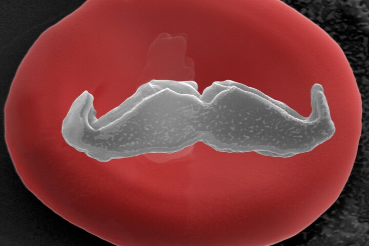 An electron microscope image of the world's smallest moustache, modeled by a red blood cell