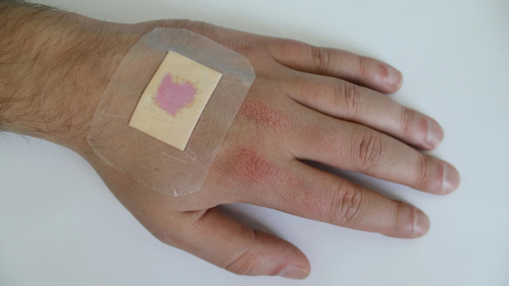 The new dressing material indicates infection by turning purple (Image: Fraunhofer EMFT)