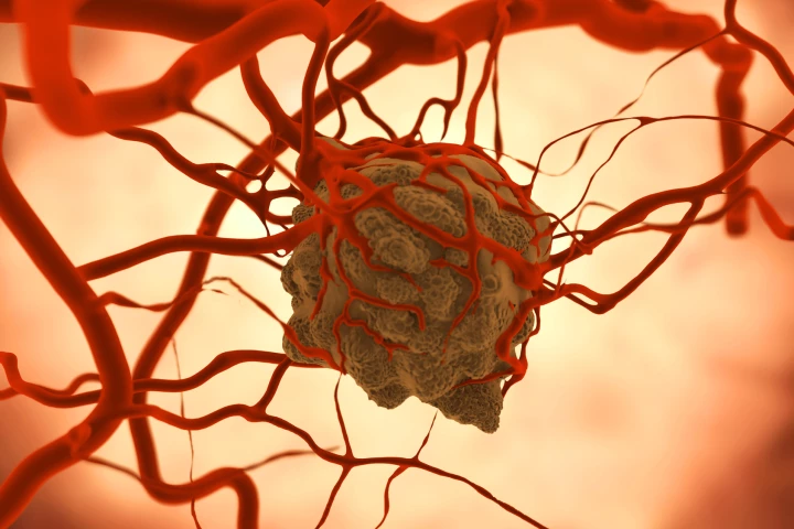 A modified version of C. noyvi bacteria has been found to produce an anti-tumor response throughout a series of studies (Image: Shutterstock)