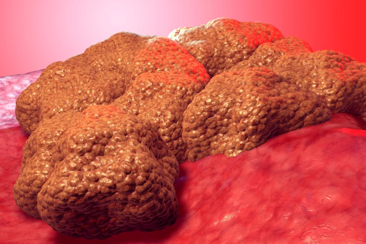 Researchers at Northwestern University have developed a way to trigger an ancient cancer "kill switch" hidden in our genes