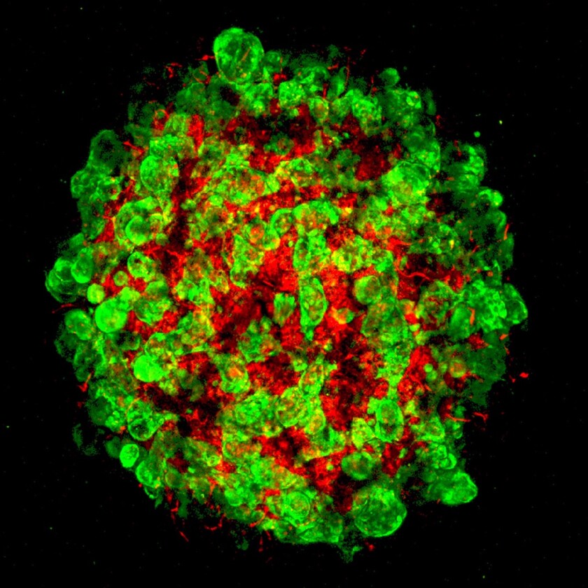 Green sections are hepatic tissue and the red are blood vessels, which need to develop together to create viable livers in the lab