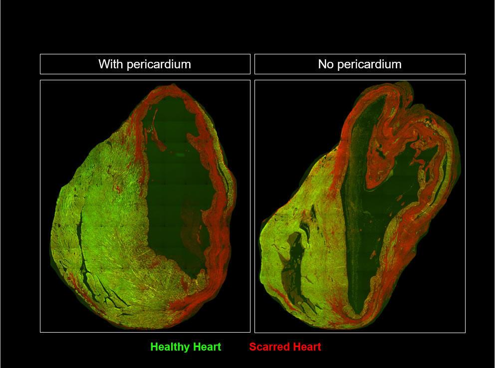 Left, a healthy mouse heart one month after a heart attack, compared to right, a mouse that had its pericardial fluid and sac removed