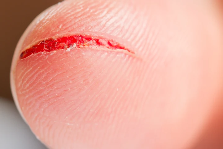 A new plastic demonstrated to the American Chemical Society on Monday not only professes to self-repair when exposed to light, but to change color when damaged in a process akin to the bleeding of human skin (Photo: Shutterstock)