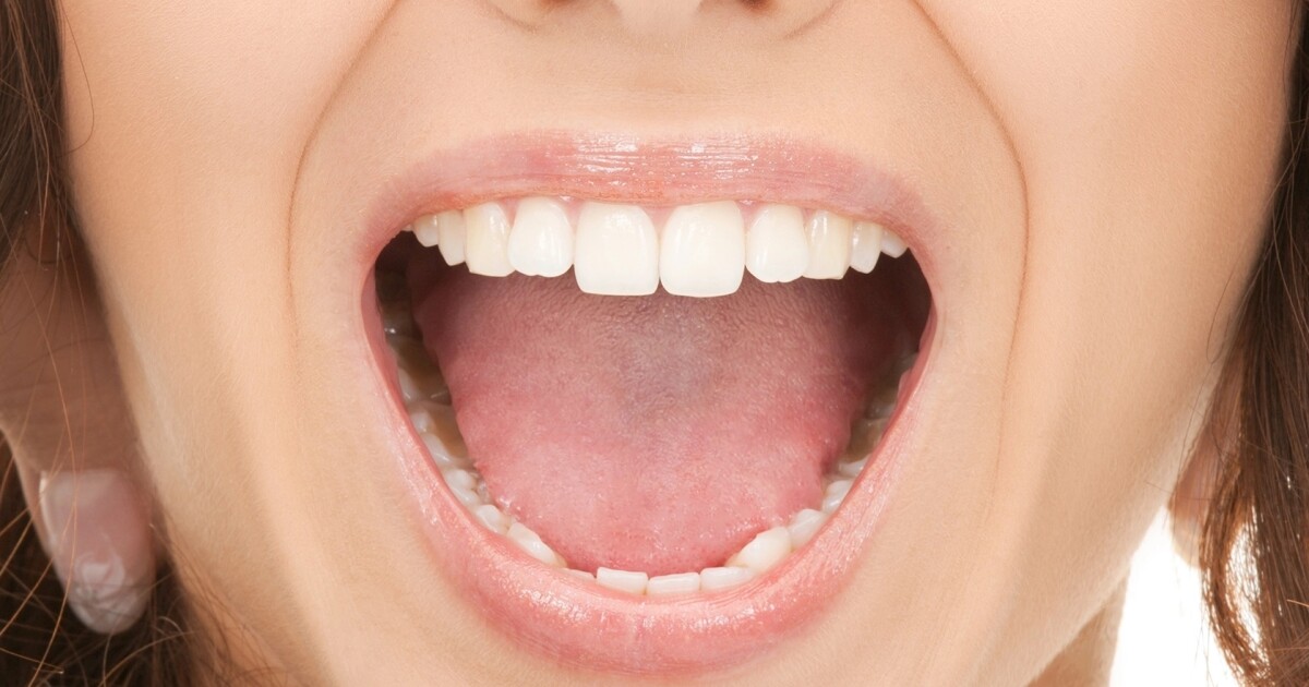 Secret to scarless healing found in mouth tissue Secret to scarless healing found in mouth tissue