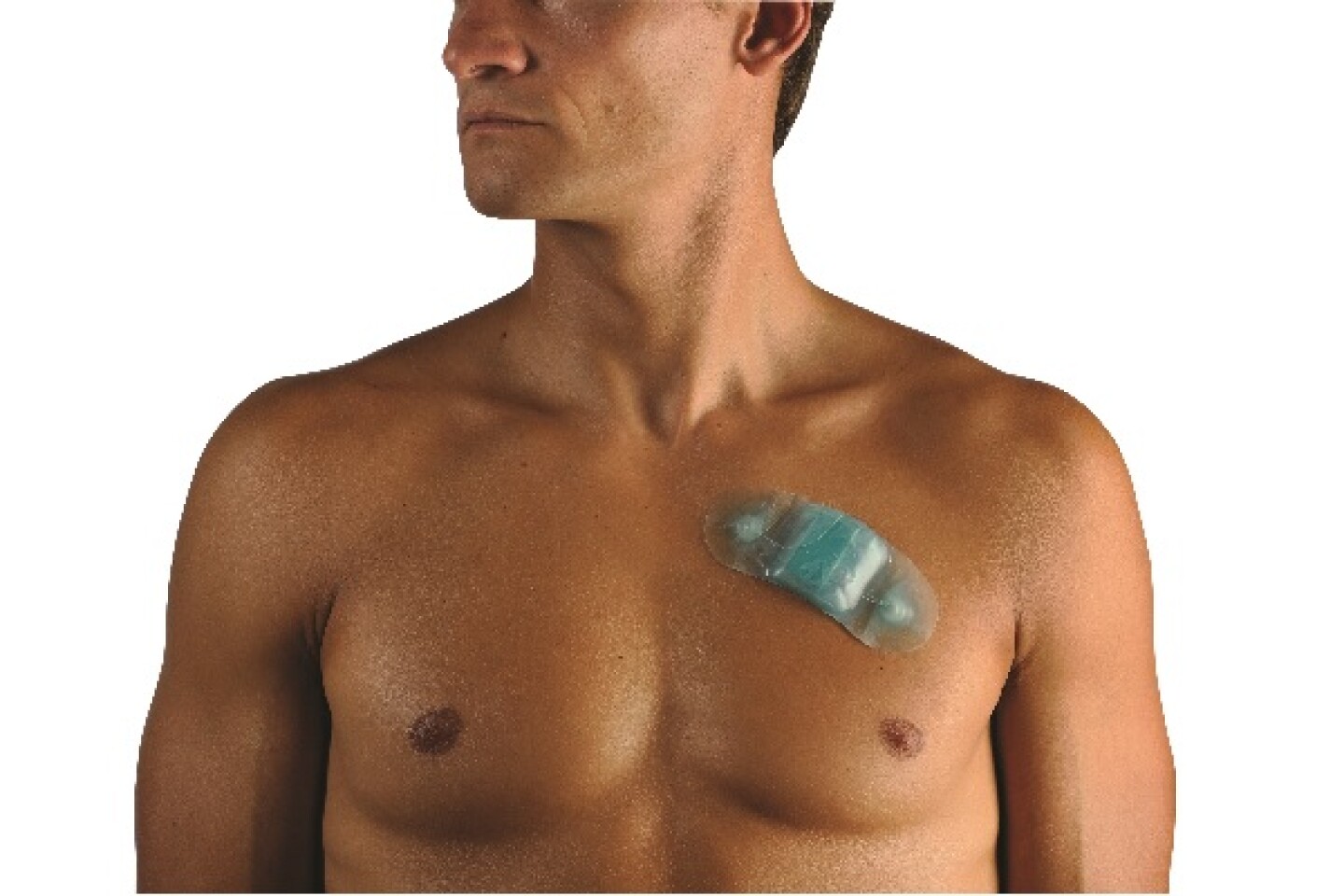 Small adhesive patch outperforms traditional tech for detecting arrhythmia