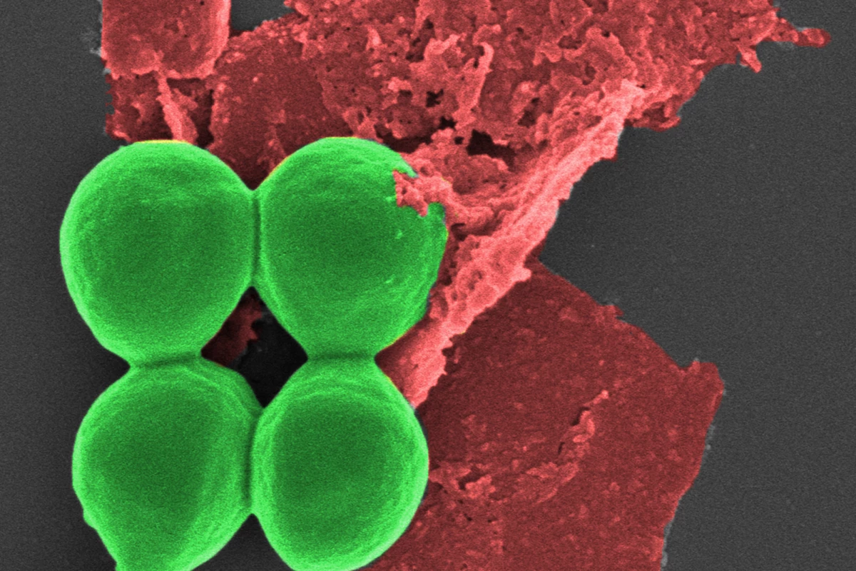 Researchers have used nano-flakes of black phosphorus (red) to kill bacteria (green)