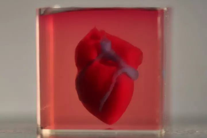 The bioprinted mini human heart in its supporting medium, which can later be removed