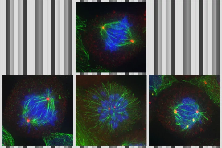 The top image shows a cell undergoing normal cell division, while the bottom three images show defects introduced into the process by the new drug duo
