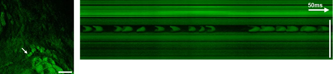 SRS images of the viable epidermis at the CH3-vibration mainly highlight proteins (left). A capillary with individual red blood cells (arrow) is visible. The cells are imaged without motion blur due to video rate acquisition speed. (right) An x-t plot acquired by line-scanning across a capillary at the position of the arrow. Individual red blood cells are captured on the fly. Scale: 25 Î¼m (Image: Dr. Brian Saar and Christian Freudiger)