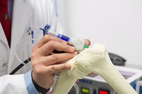 The BioPen allows a physician to heal bones faster by depositing stem cells, scaffolding, and growth factors on injured bone (Photo: University of Wollongong)