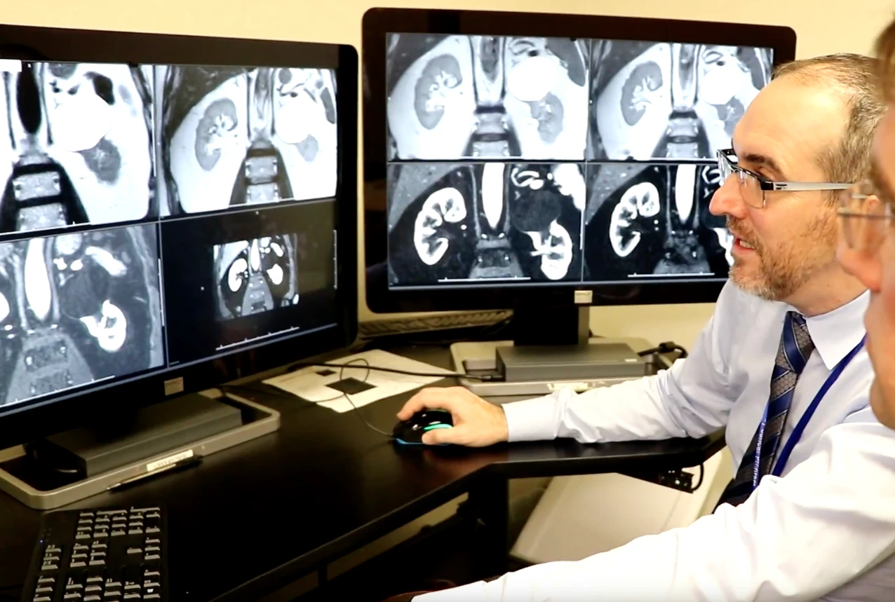 A new MRI method can confidently identify if a kidney tumor is malignant or benign without the need for a biopsy