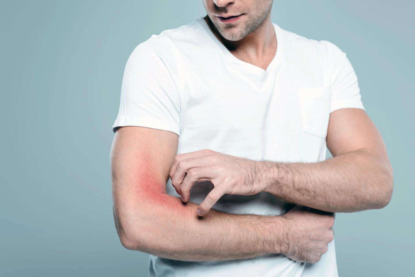 Treatments were assessed for how they reduced things like itch and wheal severity