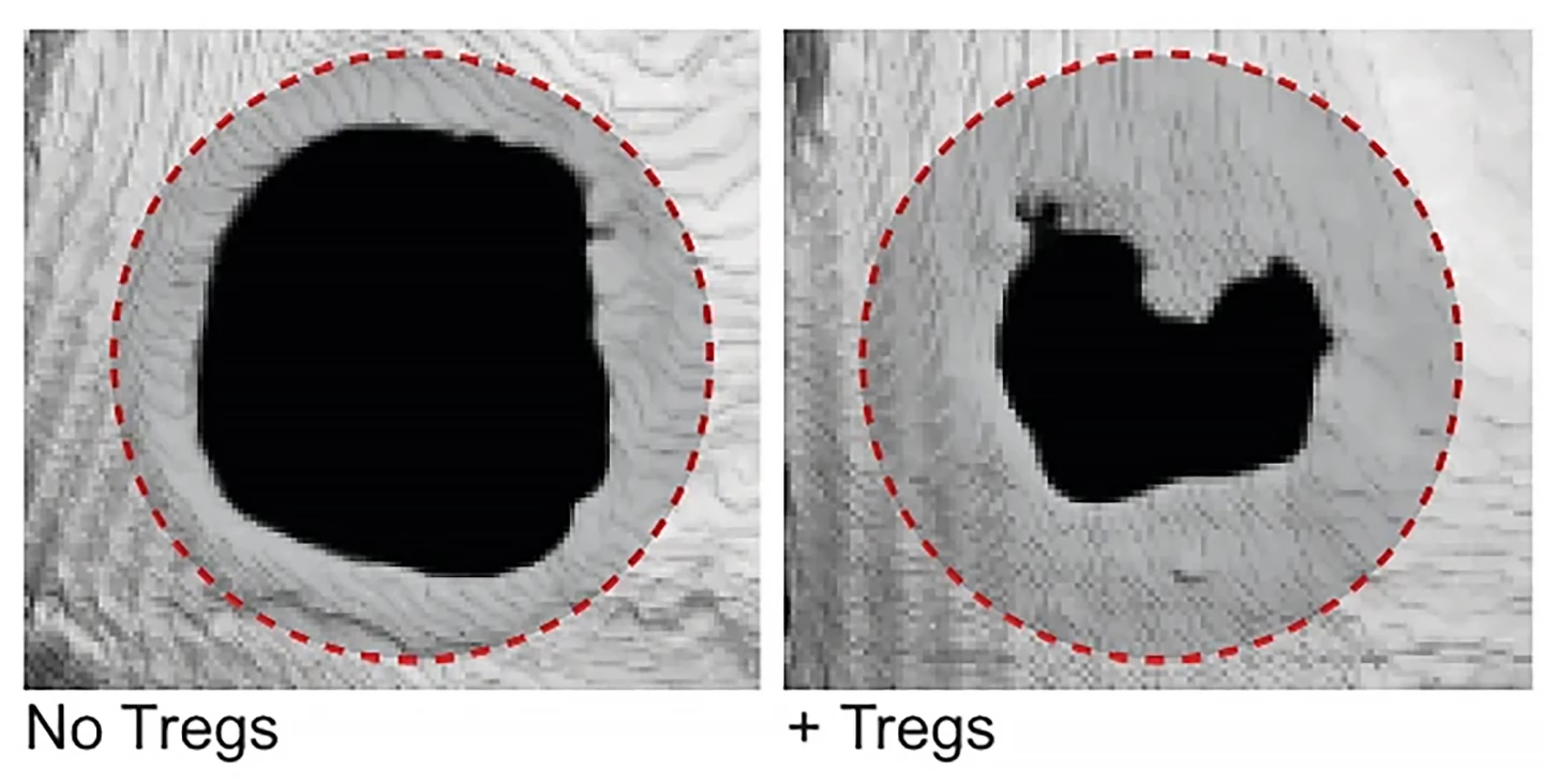 Cranial bone regeneration after injection of hydrogel with (right) and without (left) Tregs. The red dotted line indicates the size of the original defect
