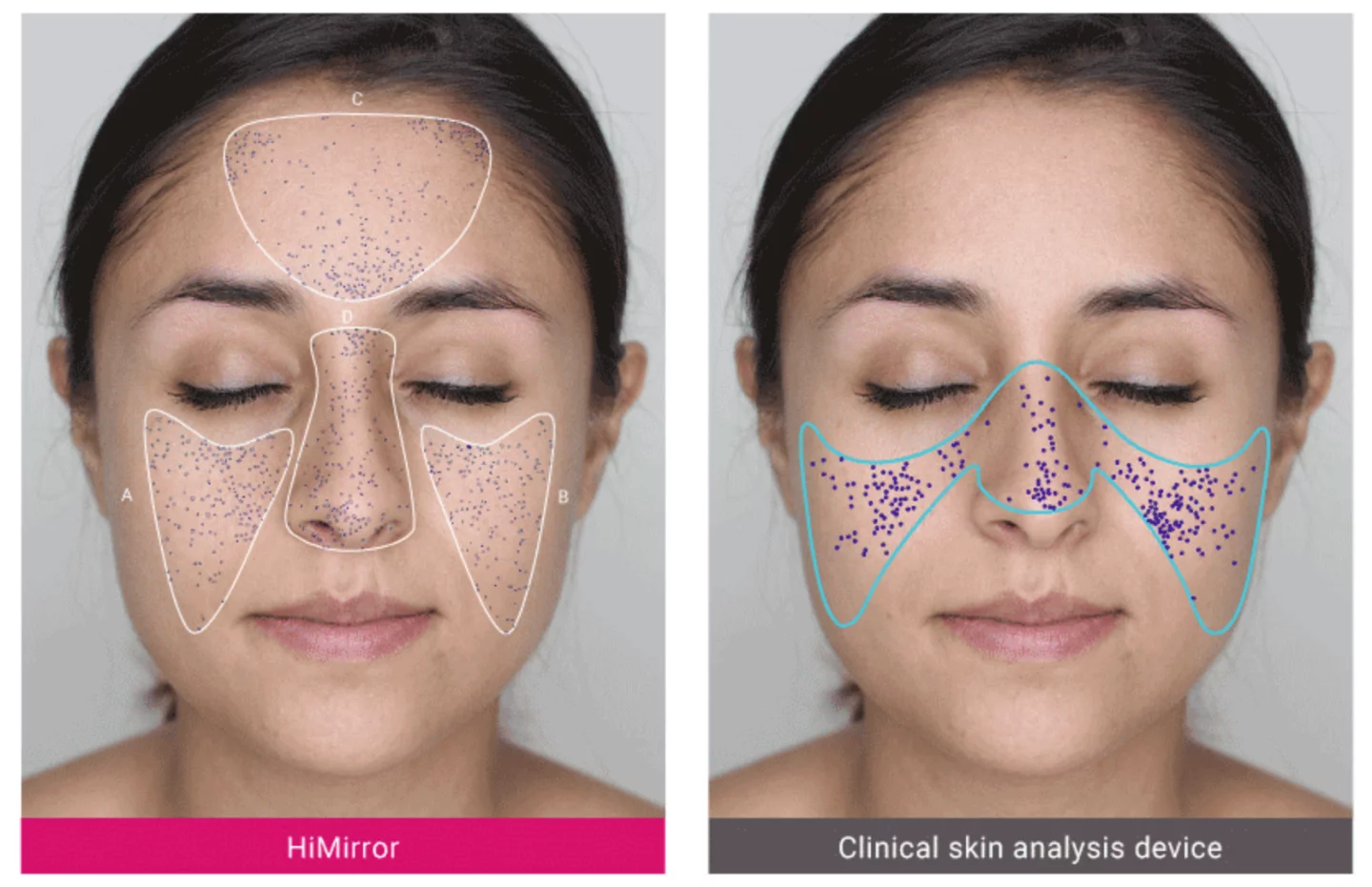 HiMirror smart mirrors claim to detect wrinkles, fine lines, dark circles, dark spots, red spots, roughness, pores, complexion issues, hydration and pigmentation