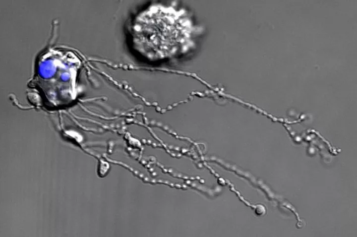 The first-of-its-kind video shows the white blood cells to eject a string of proteins as they die