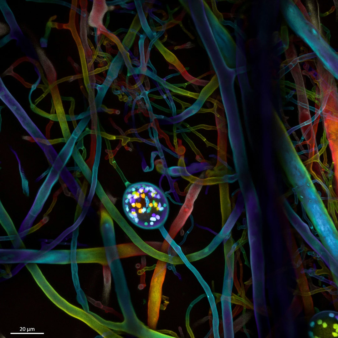 4th Place. Multi-nucleate spores and hyphae of a soil fungus (arbuscular mycorrhizal fungus)