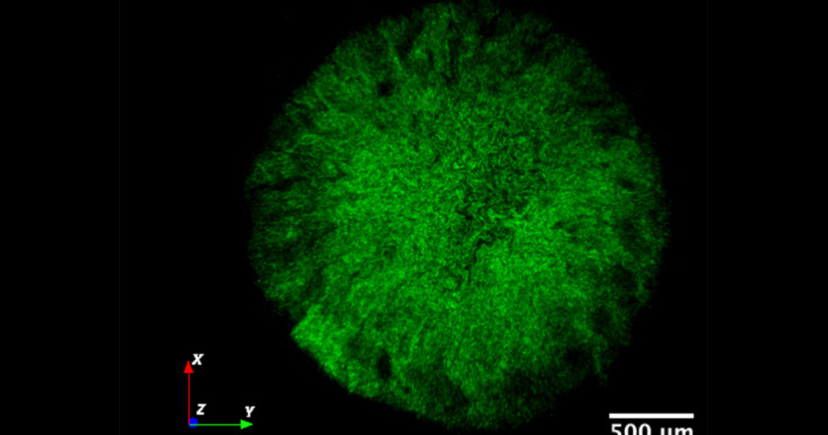 Scientists discover new "Death Star" weakness in bacterial biofilms