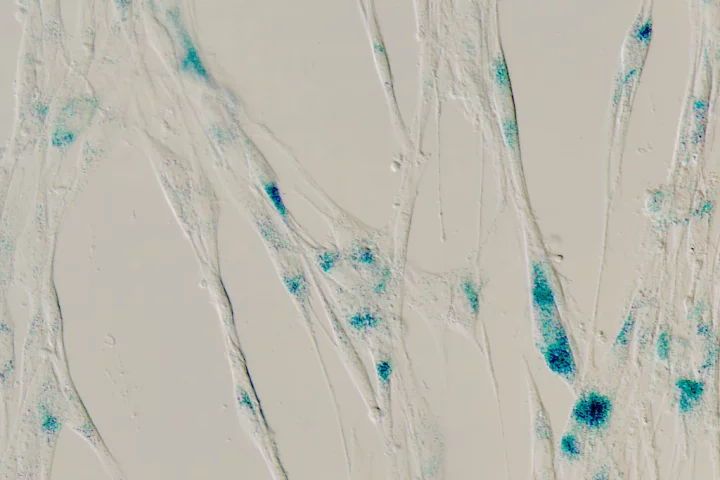 Senescent cells under a microscope, with the blue regions indicating an increase in the production of the gene CD36