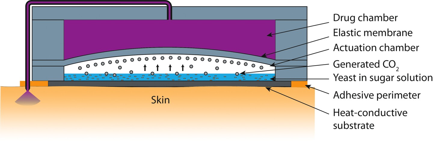 A diagram of Purdue's transdermal microneedle patch