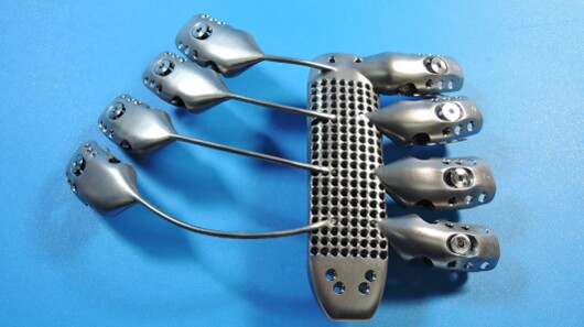 Front view of the 3D-printed sternum and rib cage implant